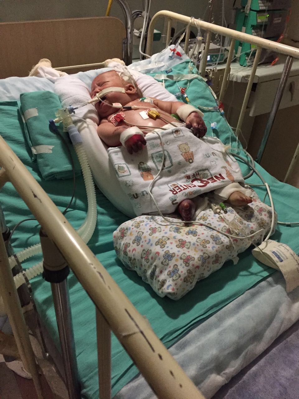 João Marcos bebê, internado na UTI durante o tratamento contra a meningite